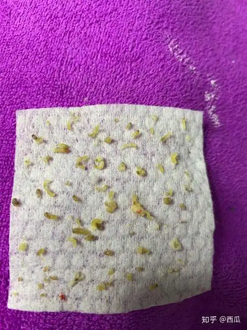 黑头大到直接挤出来是什么感受?