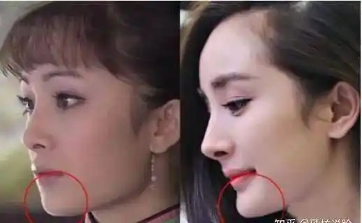 整容前冰清玉洁,恬静灵逸,整容后妩媚妖娆,容色绝丽