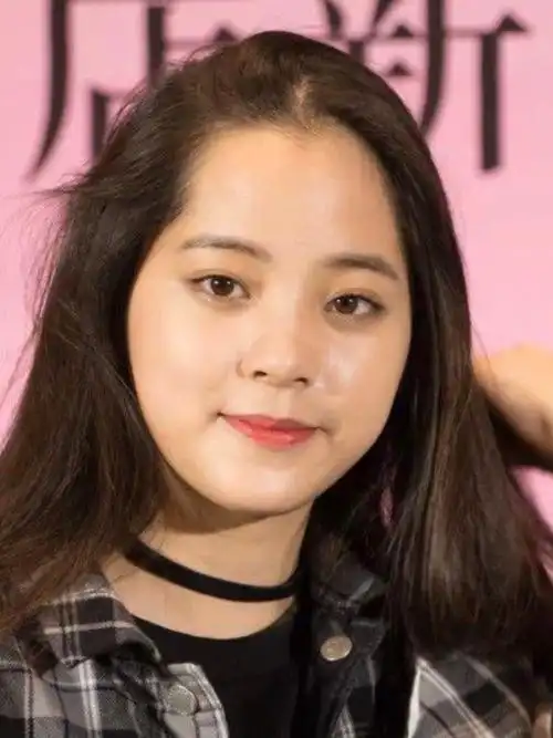 很多妹子有精致的五官,却败在一个扁平的额头,快来谢_圈子-新氧美容