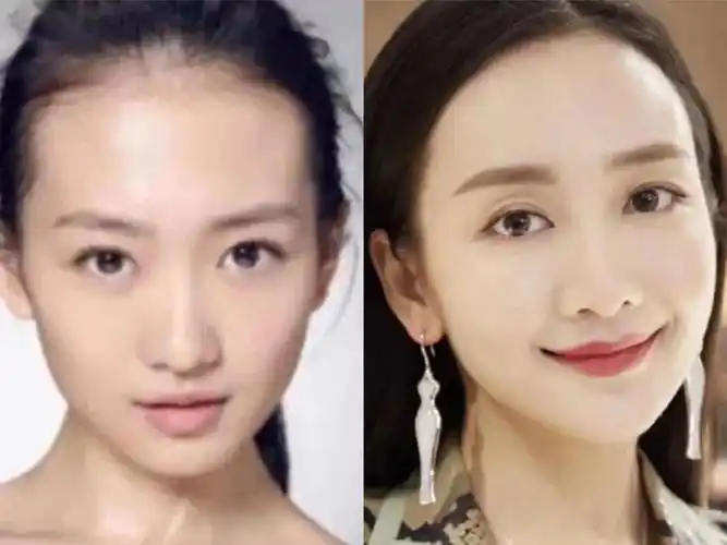 把刘亦菲的发际线修成娜扎的样子,神颜竟成了大饼脸?