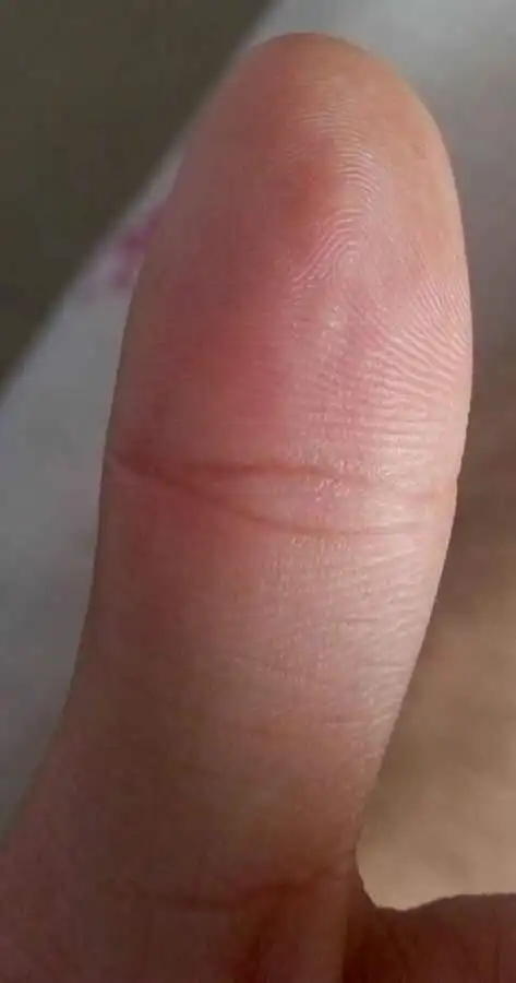 【佛眼纹】男左女右,看看你们有没有佛眼纹