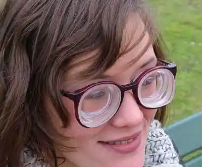 超高度近视患者