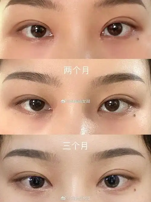 两个多月的扇形双眼皮,宽窄刚刚好,图36615是去拍写真时画的眼妆