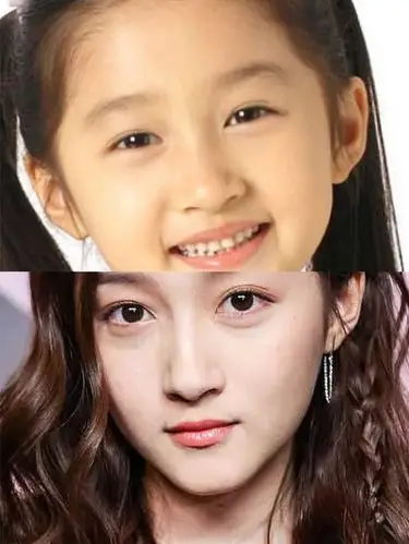 关晓彤是不是开眼角了!