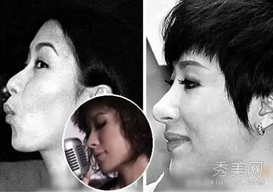 10位女星侧脸最丑 杨幂袁姗姗下巴鼻子太尖