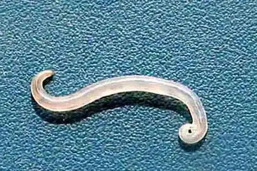 温州女宝宝私处痒,脱下裤子看,一条白色蠕动的虫子!