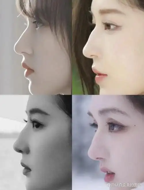 女生是驼峰鼻好看吗?