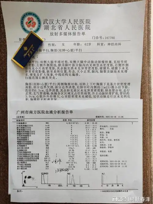 妇科检查白带为脓性或血性宫外孕的早期症状可能并不明显怀孕尿检