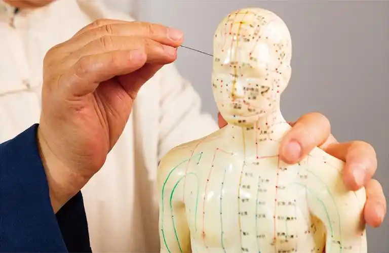 中医精准治面瘫态靶针灸当首选