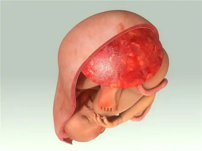 胎盘问题可能扼杀宝宝?准妈妈需警惕!