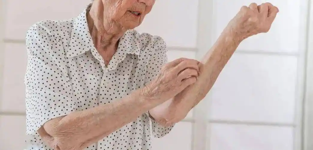 冬天一到全身发痒这种越挠越痒的皮肤疾患中老年人要注意