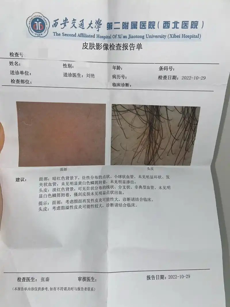 皮肤镜检测 真菌检测 过敏原检测 做过检查的报告单,如果你的症状跟我