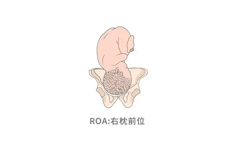 胎位roa图片_39健康网_精编内容