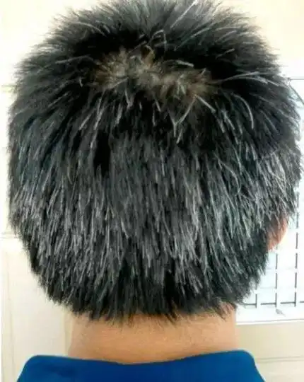 「生活」白头发长在哪里最危险?年轻人的白发问题不容忽视