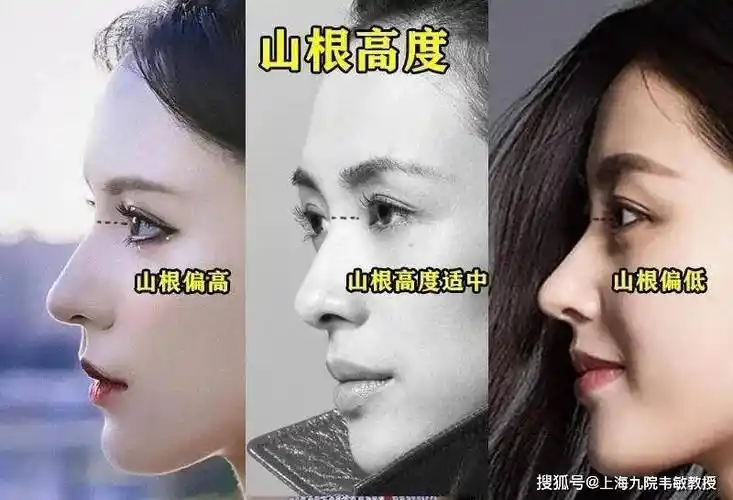 原创九院韦敏教授丨鼻子扁塌只是因为山根低吗也许这个原因
