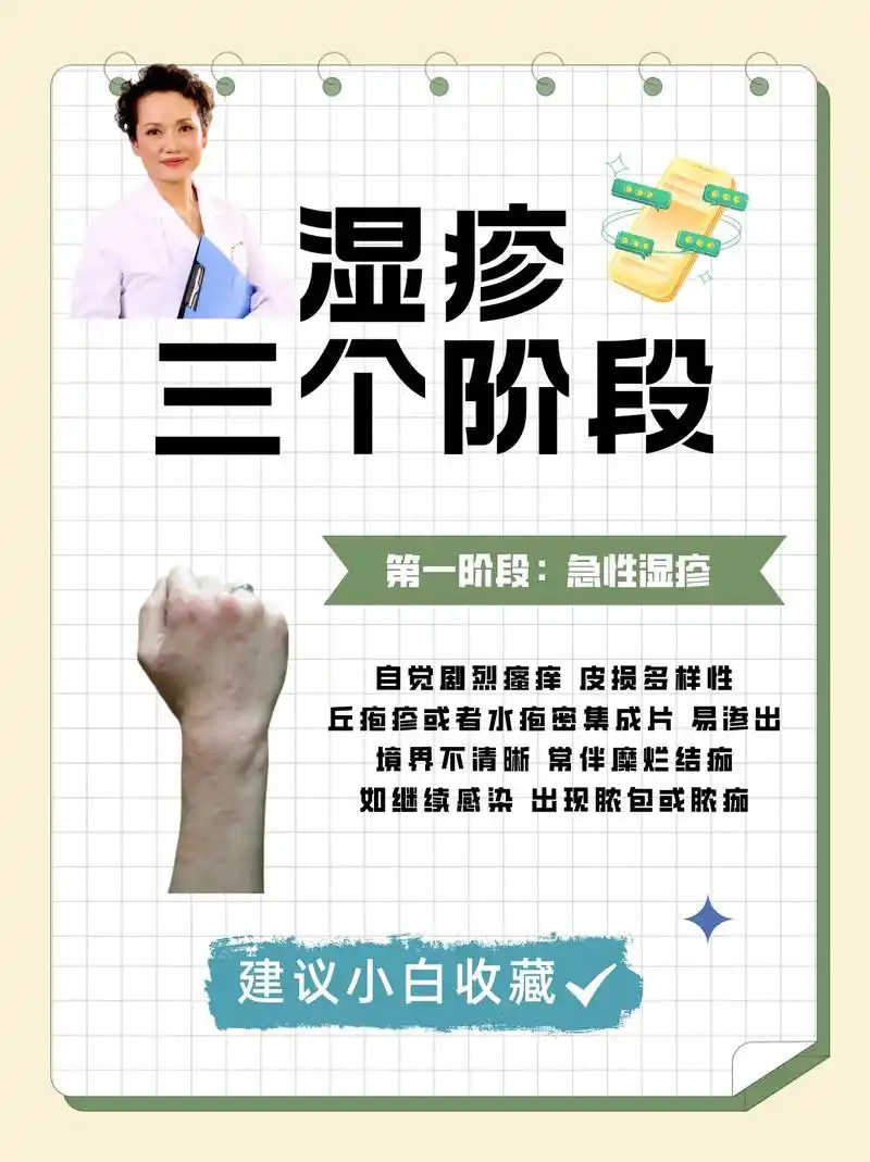 一天比一天更痒,什么是湿疹?#皮肤科医生邹勇莉  #云南皮 - 抖音