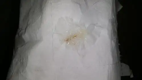 排卵期,白带第一天带有褐色分泌物,怎么回事?