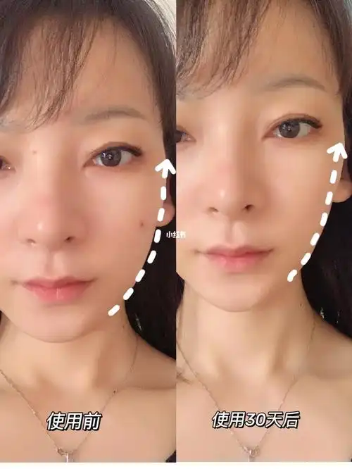 想让皮肤紧致起来松下美容仪yyds