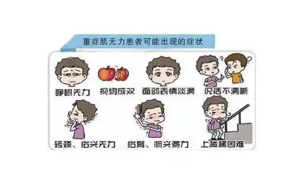 重症肌无力---儿童型|免疫性疾病|症状_网易订阅