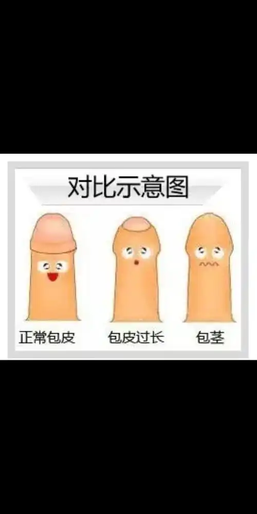 小孩包皮割不割?开封同济医院告诉您