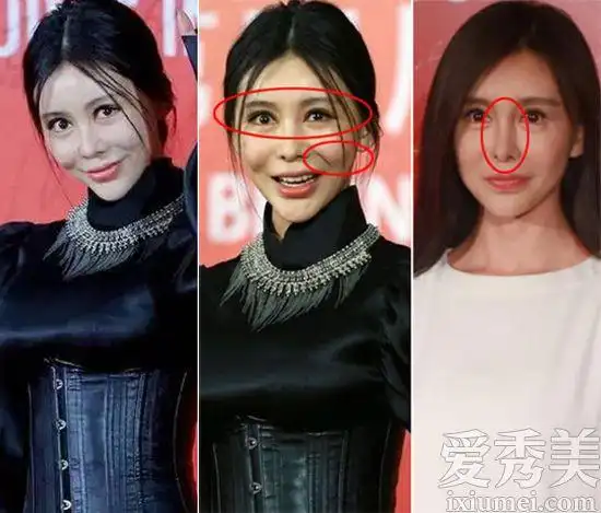 女星整容后遗症吓死人 baby巩新亮李小璐郑爽