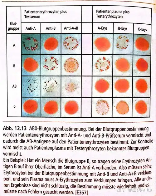 abo血型血细胞比容与缺铁性贫血每日铁代谢示意图红骨髓凝血模式图