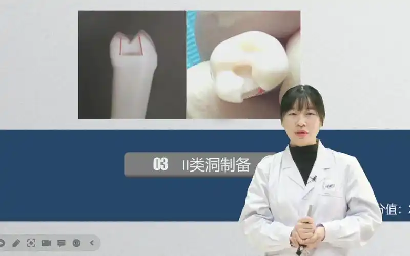 【牙满分】口腔实践技能二类洞的分类