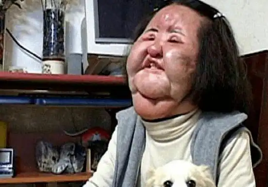 10位"整容变毁容"的女星,有几位曾经美艳动人,现在却无颜见人_黄夏蕙