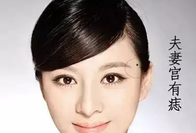 这些痣看你是不是会婚姻不顺?