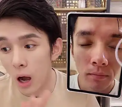 李佳琦早期照片流出红肿痘坑没眼看网友还我男神