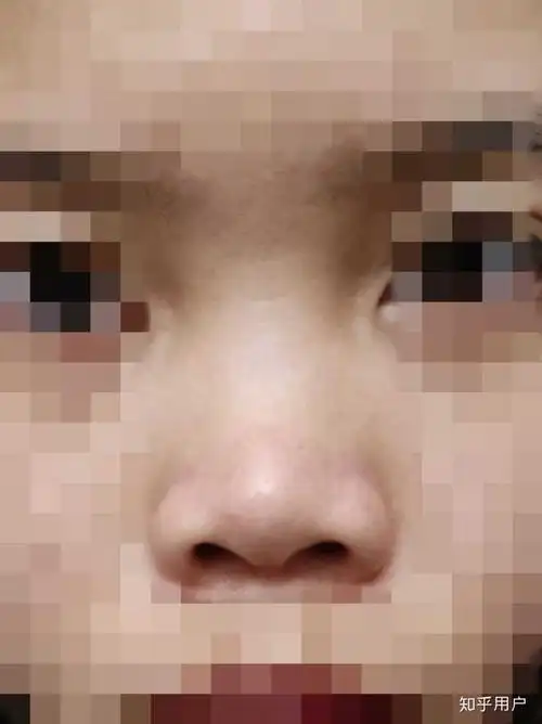 那些有鼻梁的姐妹知足一点吧!