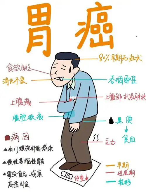 医学生笔记胃癌