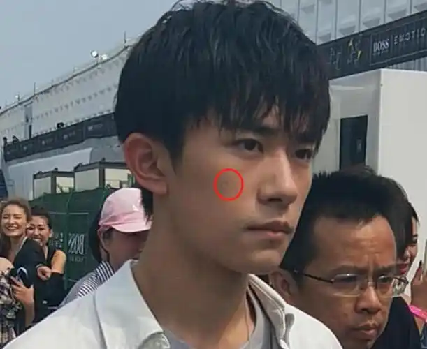 易烊千玺高清生图意外发现脸上的疤痕网友这就是素颜