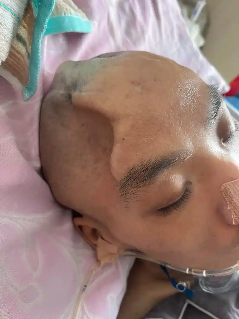 我就想你能活着,能多陪陪我.看着你满头伤疤,没有一寸完整的皮 - 抖音