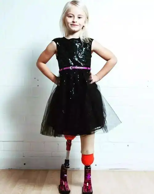 来残缺,备受欺凌,她却做了一个这样的决定…|假肢|女孩|双腿_新浪新闻