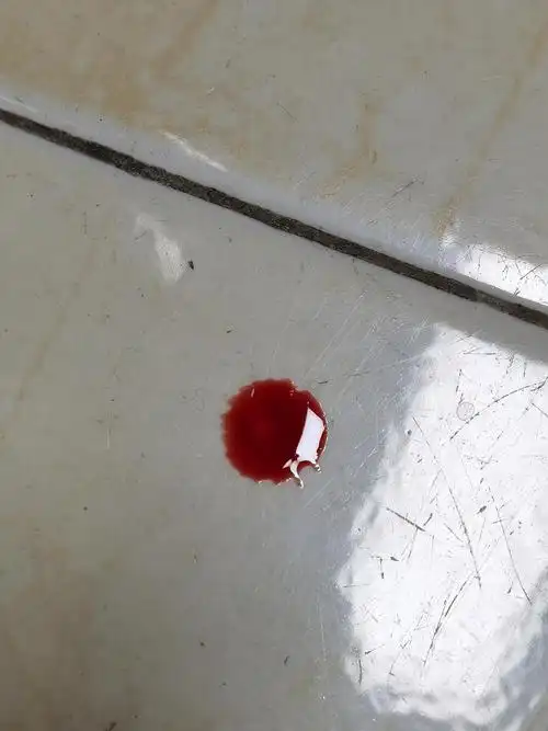 无缘无故发现厕所一滴血迹不知怎么来的有友友看得出来吗