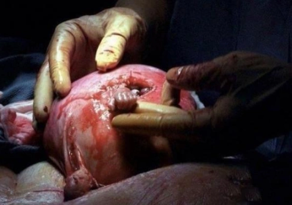 这张照片曾感动无数人,伟大的生命让人惊叹.