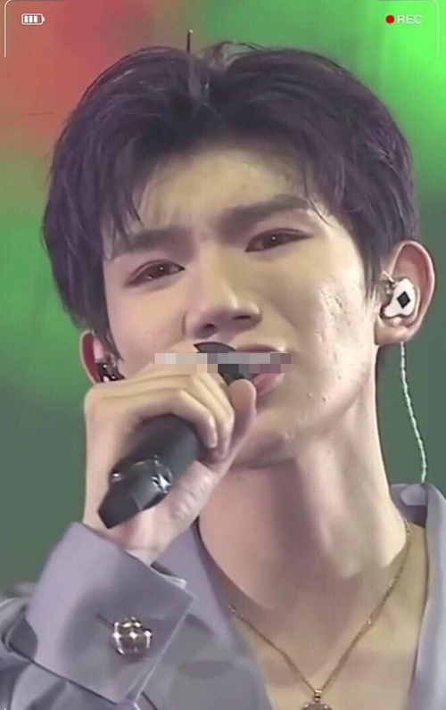 王源嫩的掐得出水未修图一脸痘坑太一言难尽吸烟的影响太大了