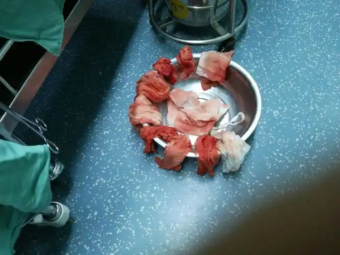 手术中和手术后纱布放整齐清点