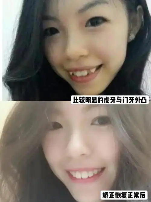 虎牙女生矫正记录Ⅰ笑起来超好看的999990顾客小姐姐的_圈子