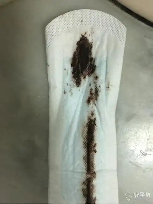 昨天晚上出血后躺着睡觉,半夜起来上厕所用纸巾擦拭还有深红色的血.