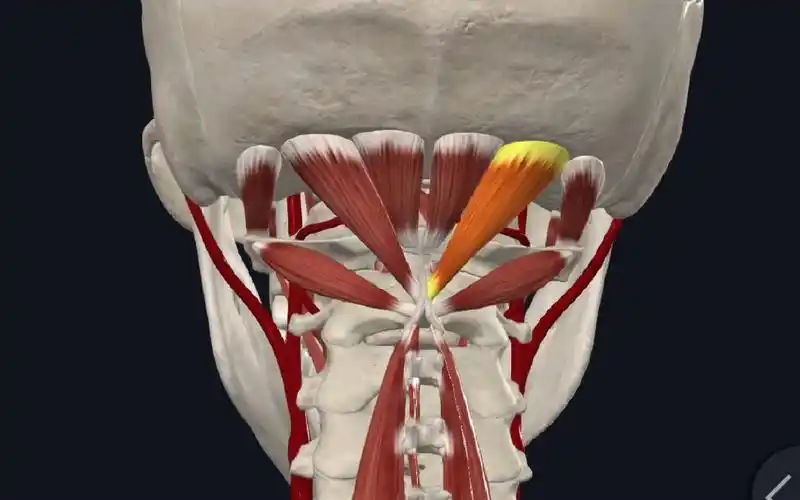 头晕头痛怎么办? ——枕下肌群解剖特点