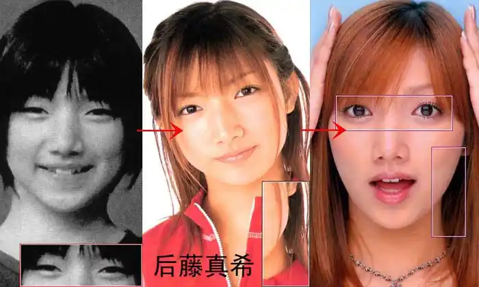 日本明星艺人整容前后照片曝光女星篇对比一下