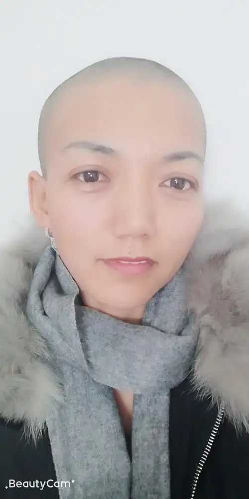 哪个剃光头的女人究竟怎么了