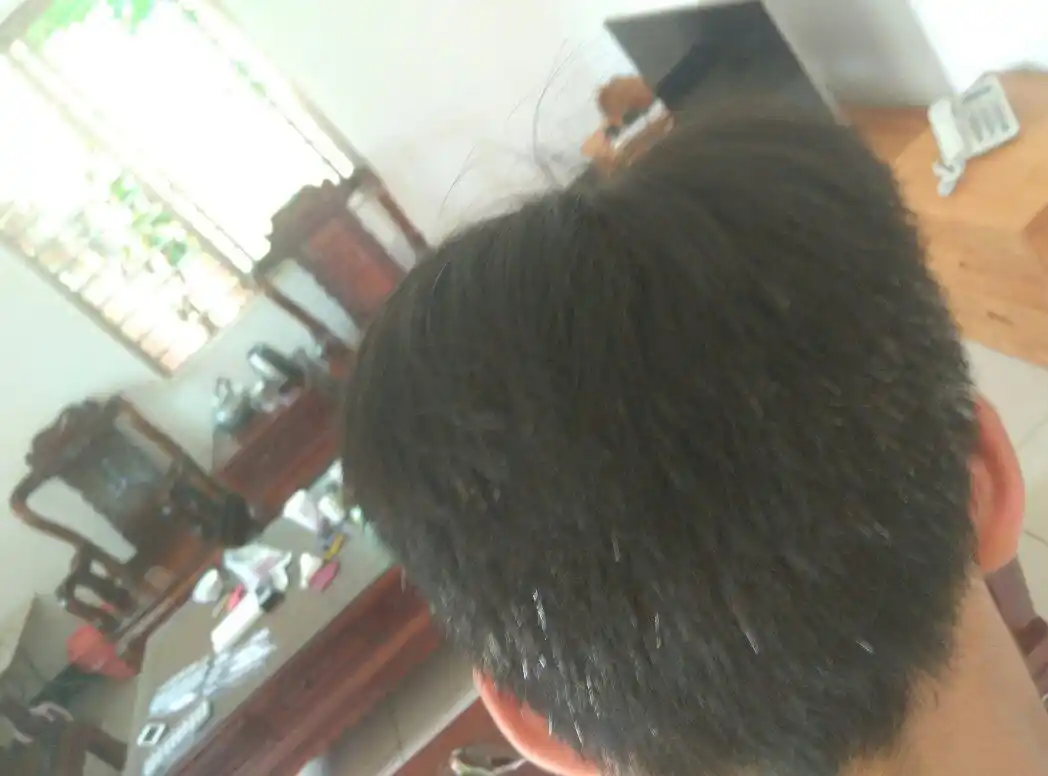 我后脑勺两侧长了很多白头发,现在服用这种药能好吗?