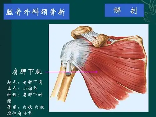 肱骨外科颈骨折 解 剖 肩胛下肌 起点:肩胛下窝 止点:小结节 神经