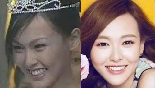 锦绣未央唐嫣演技受好评整容前的旧照曝光