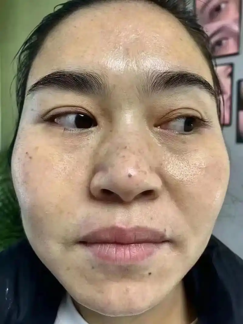 时间就是最好的答案,皮肤不是一天两天就变差的,也不是一天两天 - 抖