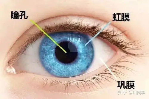 重女轻男的巩膜炎大家要小心啦