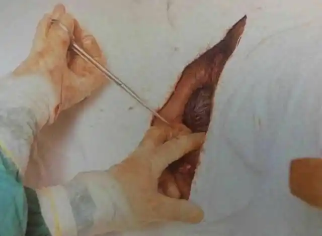 孕妇生孩子全过程|真人图